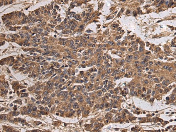 Rabbit Polyclonal Antibody to TLL1