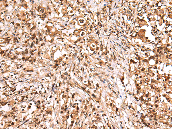 Rabbit Polyclonal Antibody to PHAX