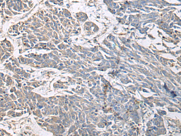Rabbit Polyclonal Antibody to PRKCSH