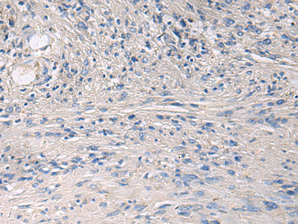 Rabbit Polyclonal Antibody to PRKCSH