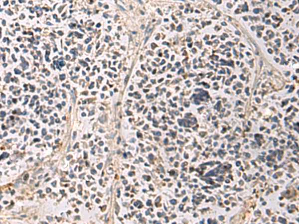 Rabbit Polyclonal Antibody to PAIP1