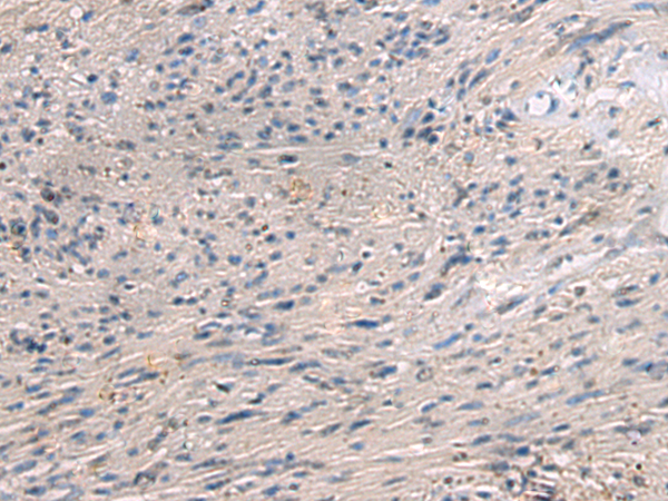 Rabbit Polyclonal Antibody to PAIP1