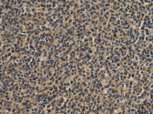 FRG1