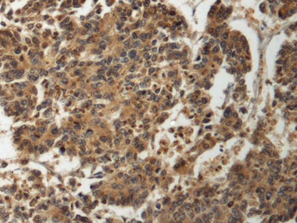 GTPBP2