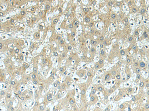 Rabbit Polyclonal Antibody to KBTBD8