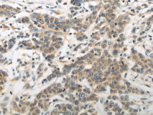 Rabbit Polyclonal Antibody to GSDMA