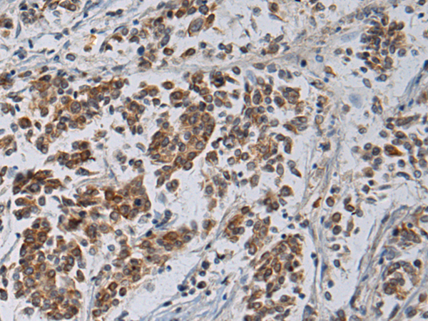 Rabbit Polyclonal Antibody to TSSK4
