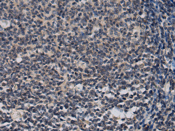 Rabbit Polyclonal Antibody to GLT8D1