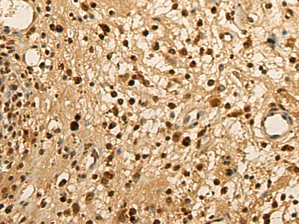 Rabbit Polyclonal Antibody to POLB