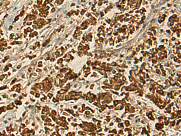 Rabbit Polyclonal Antibody to POLB