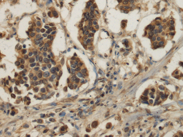 Rabbit Polyclonal Antibody to IL1RL2