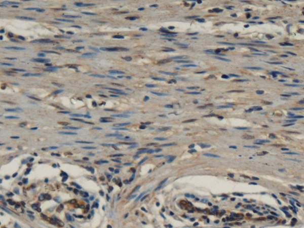 Rabbit Polyclonal Antibody to IL1RL2