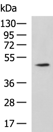 MCRS1