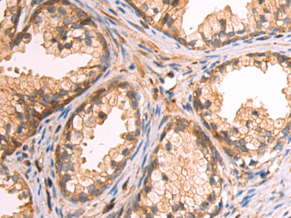 OSGIN2