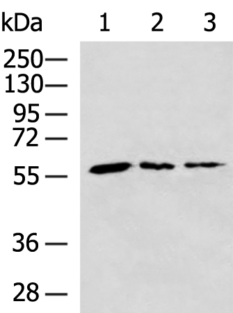 PGM3