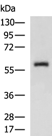 ABHD16A