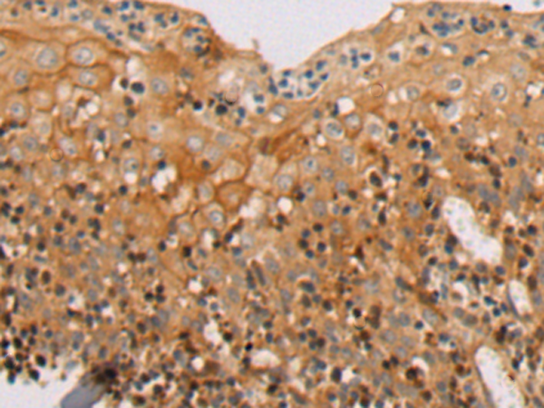 RHPN2
