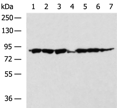 ZNF184