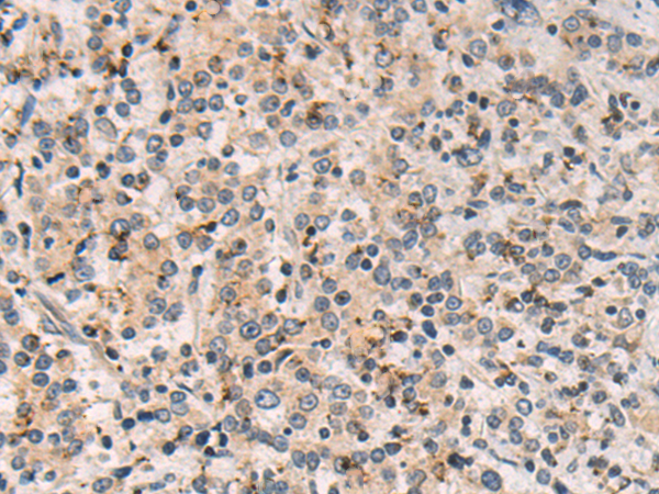 Rabbit Polyclonal Antibody to COPB2