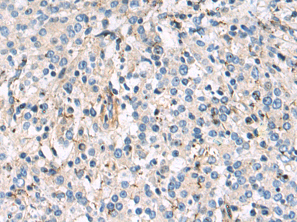 Rabbit Polyclonal Antibody to PPFIA1