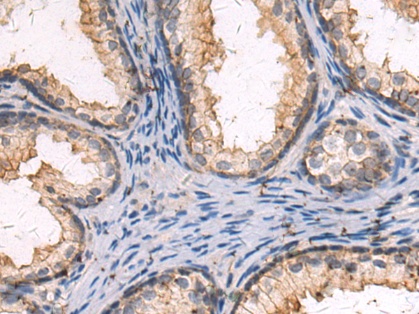 Rabbit Polyclonal Antibody to DNAJB8