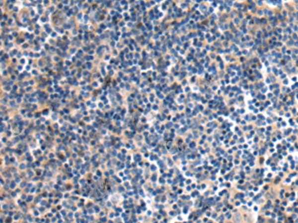 Rabbit Polyclonal Antibody to DNAJB8