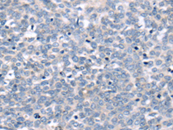 Rabbit Polyclonal Antibody to SBDS