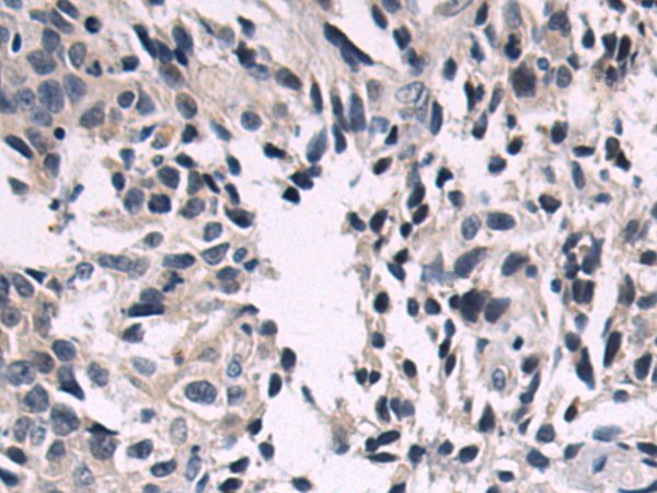 Rabbit Polyclonal Antibody to SBDS