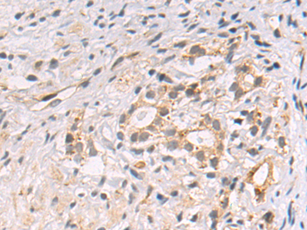 SIMC1