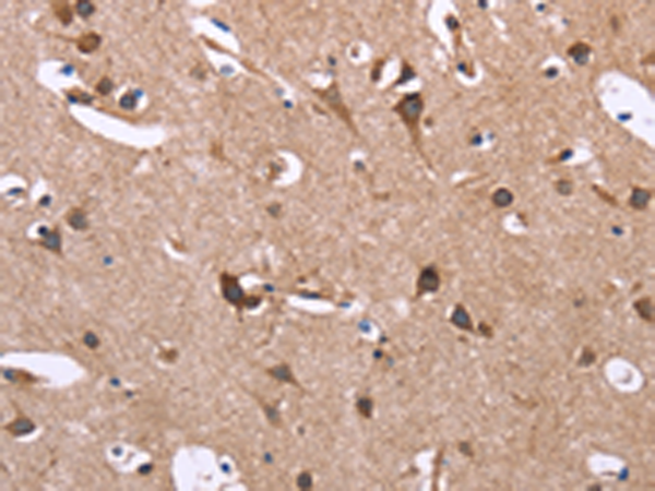 Rabbit Polyclonal Antibody to SERPINA1