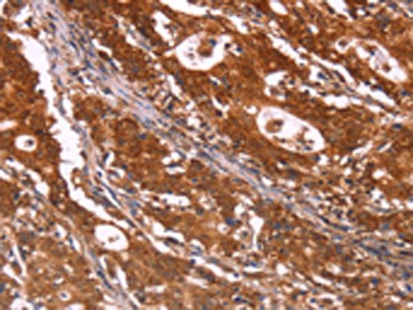Rabbit Polyclonal Antibody to ABI1