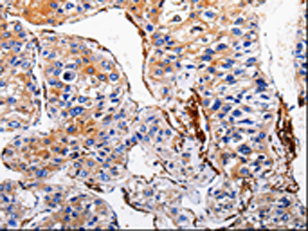 Rabbit Polyclonal Antibody to ACE2