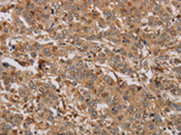 Rabbit Polyclonal Antibody to ACHE
