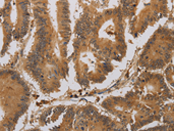 Rabbit Polyclonal Antibody to ACHE