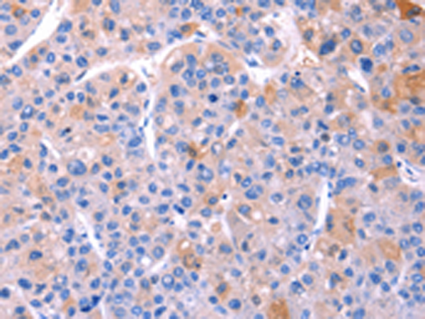 Rabbit Polyclonal Antibody to ADM2
