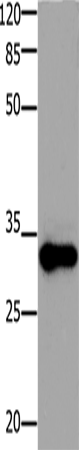 ADO