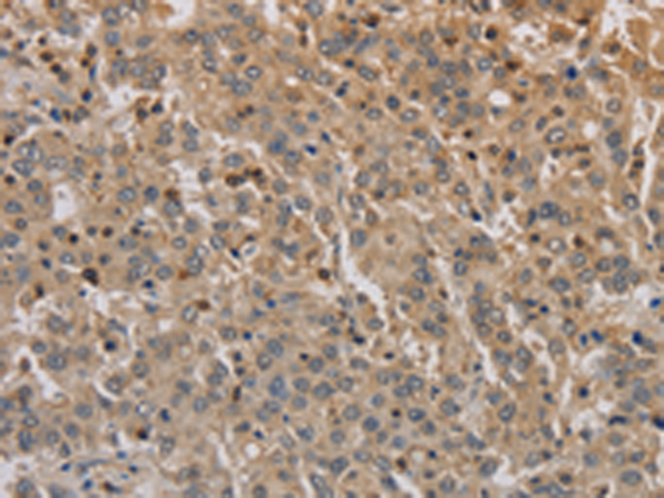 Rabbit Polyclonal Antibody to ADO
