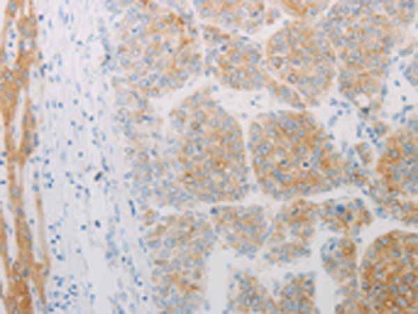 Rabbit Polyclonal Antibody to ADRB2