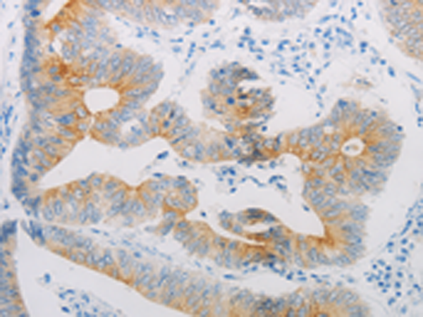 Rabbit Polyclonal Antibody to ADRB2