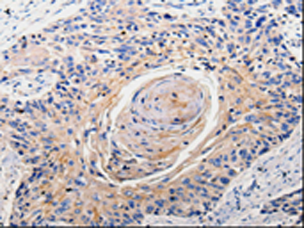 Rabbit Polyclonal Antibody to RAB22A