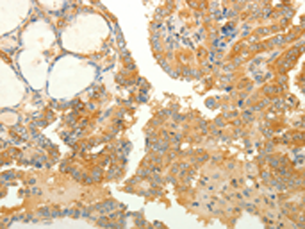Rabbit Polyclonal Antibody to RAB35