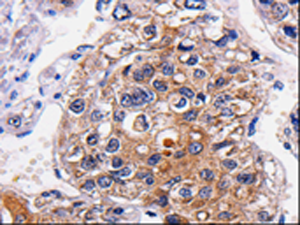 Rabbit Polyclonal Antibody to ALK