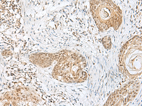 Rabbit Polyclonal Antibody to PRKAA1