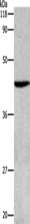 ATG4B