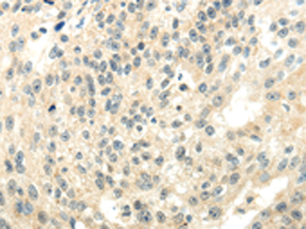 CYP19A1