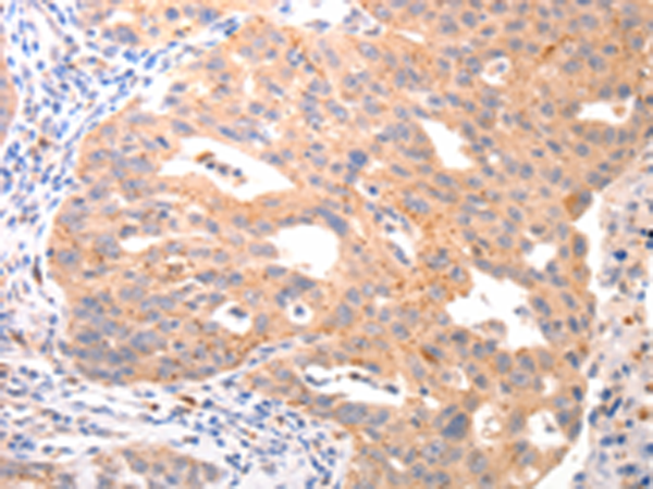 VTCN1