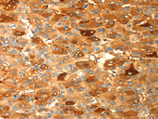 DPYSL2