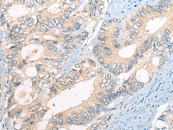 CTLA4