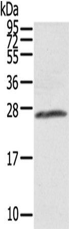 AQP1