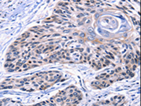 CCNB2